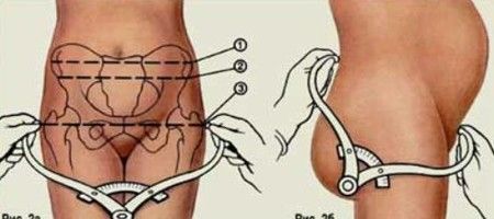 как измеряют таз при беременности